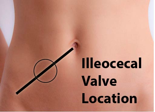 ileocecal valve location